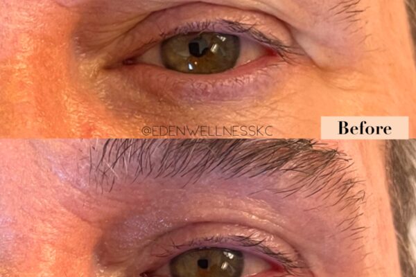 NuVissa Bleph B_A NuVissa Bleph B_A