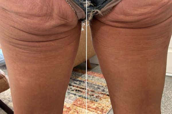 NuVissa Electrophoresis - Banana Rolls NuVissa Electrophoresis - Banana Rolls