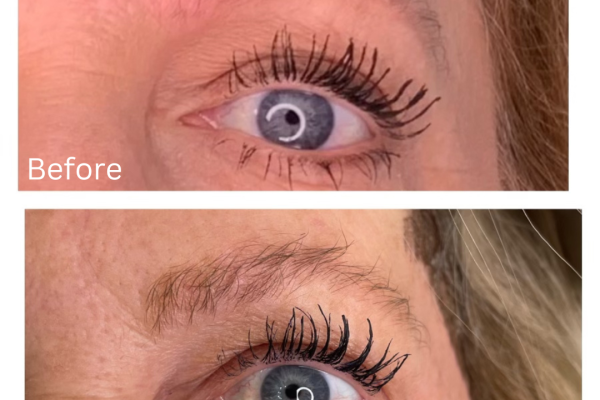 NuVissa Eyelift B_A NuVissa Eyelift B_A